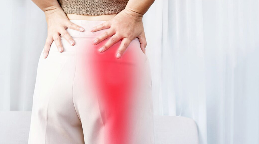 Sciatalgia (sciatica): come curare l’infiammazione al nervo sciatico.